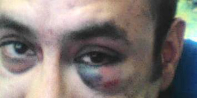 Police beat up Frontier Post journalist